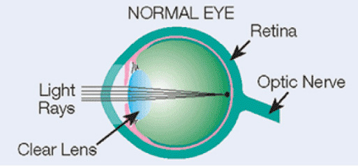 Normal eye