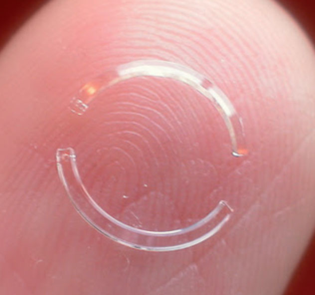 Corneal implants on finger
