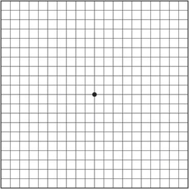 Macular hole symptoms